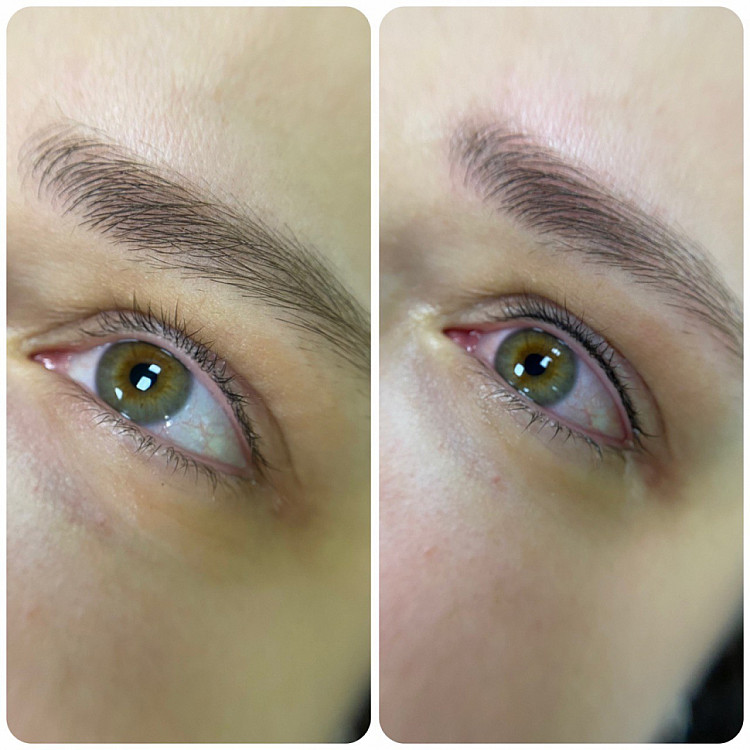 Межресничка