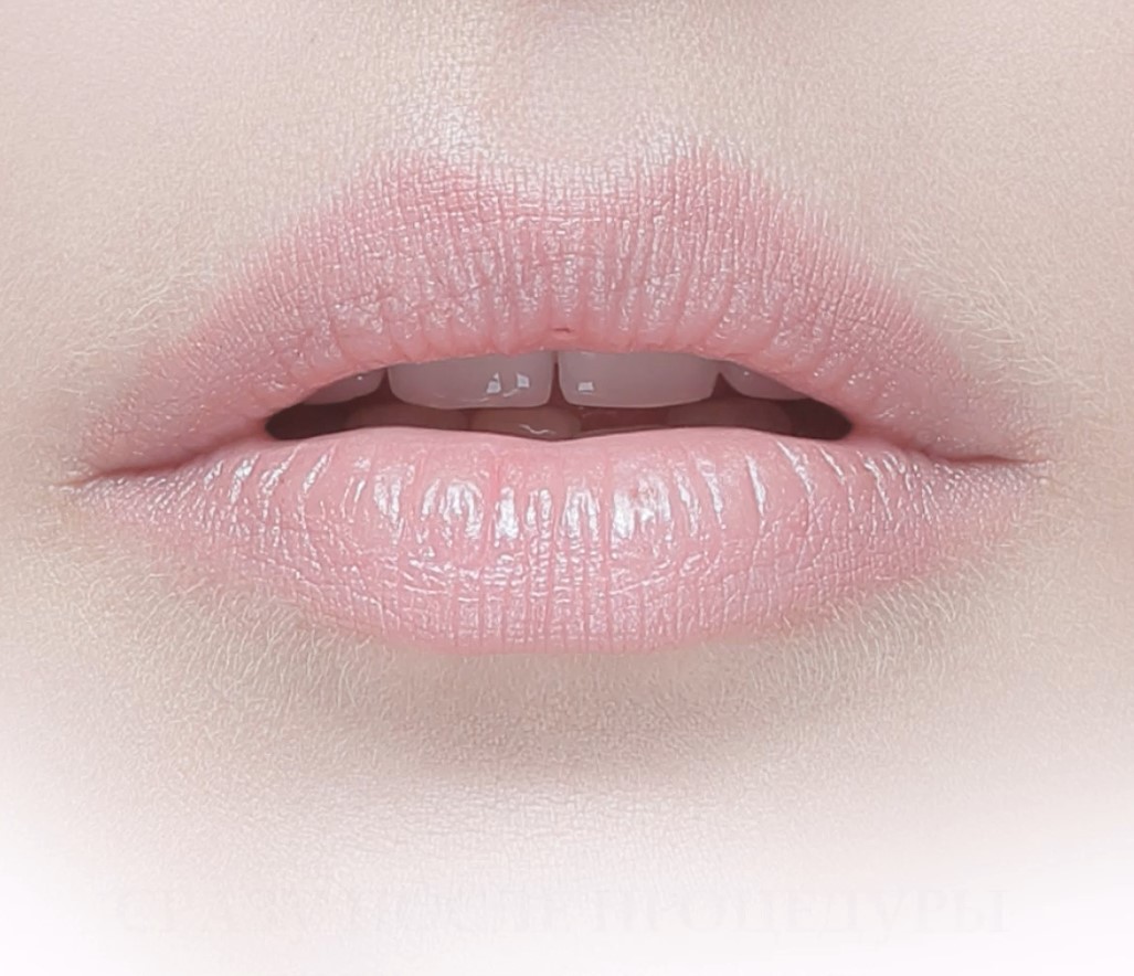 Губы до процедуры