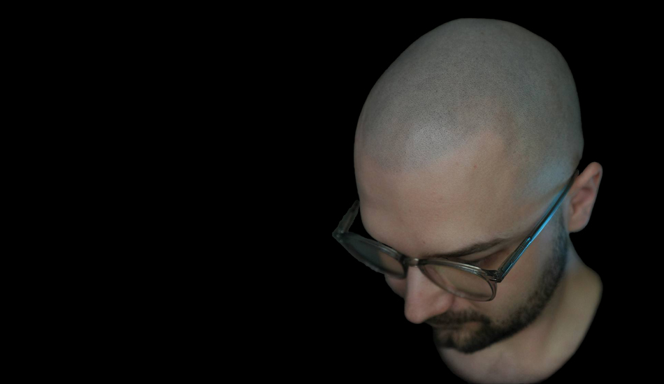 Трихопигментация